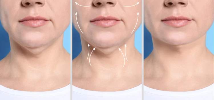 Máscara de Contorno Facial - Suaviza Rugas, Papada e Modela o Rosto