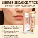 Removedor de Cicatriz Cicatriderme - Lavanda