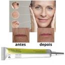 Retinol Rejuvenescedor