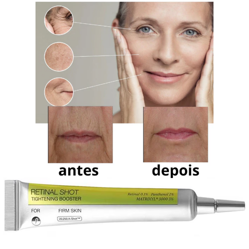 Retinol Rejuvenescedor