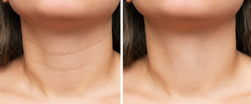 Creme antí-flacidez lifting instantâneo ROLON FIRMx®