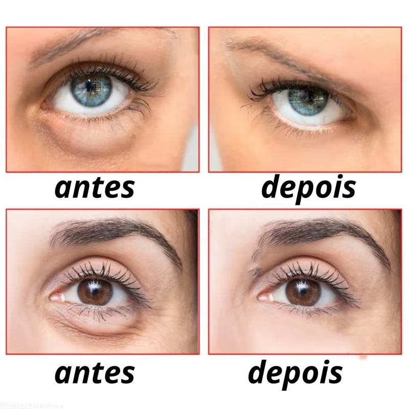 Retinol Rejuvenescedor