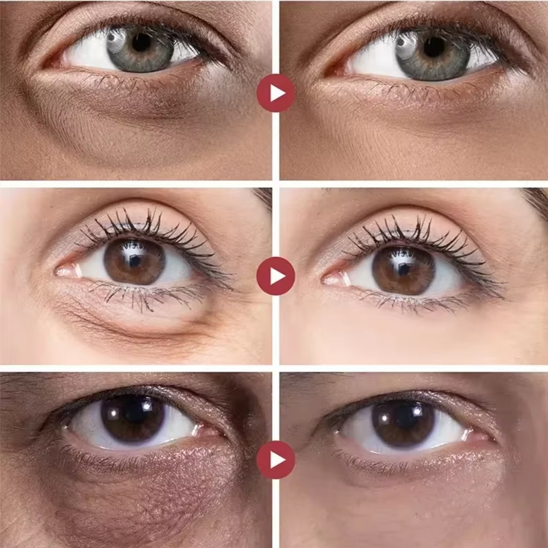 Face lift rejuvenescedor instantâneo