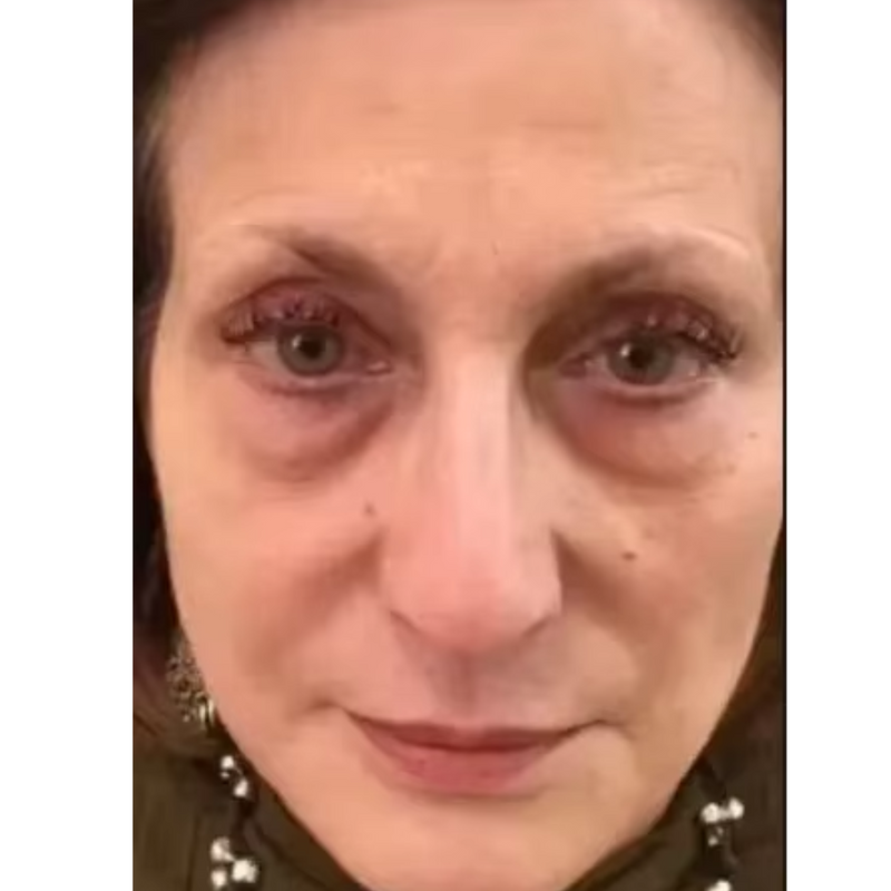 Retinol Rejuvenescedor