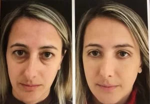 Spray Rejuvenescedor 577