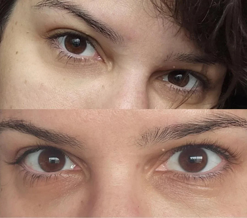 Roll-on Rejuvenescedor 4 em 1